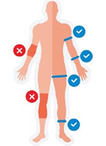 Body diagram showing correct HemaClear placement sites (wrist, deltoid/biceps, ankle, and groin) marked with checkmarks, and incorrect sites (elbow and knee) marked with red X's